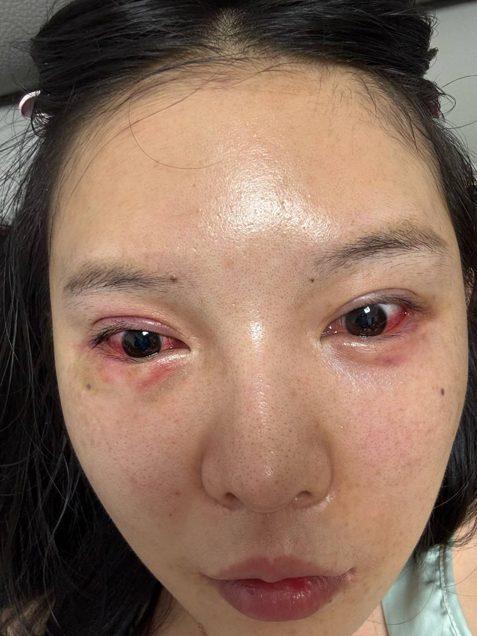 小姐姐投稿 我在一个公司正常上班，西港市赢家的妈咪和客人老婆冲进来打我